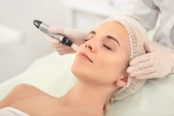 Microneedling Training Course (1 Day) 1